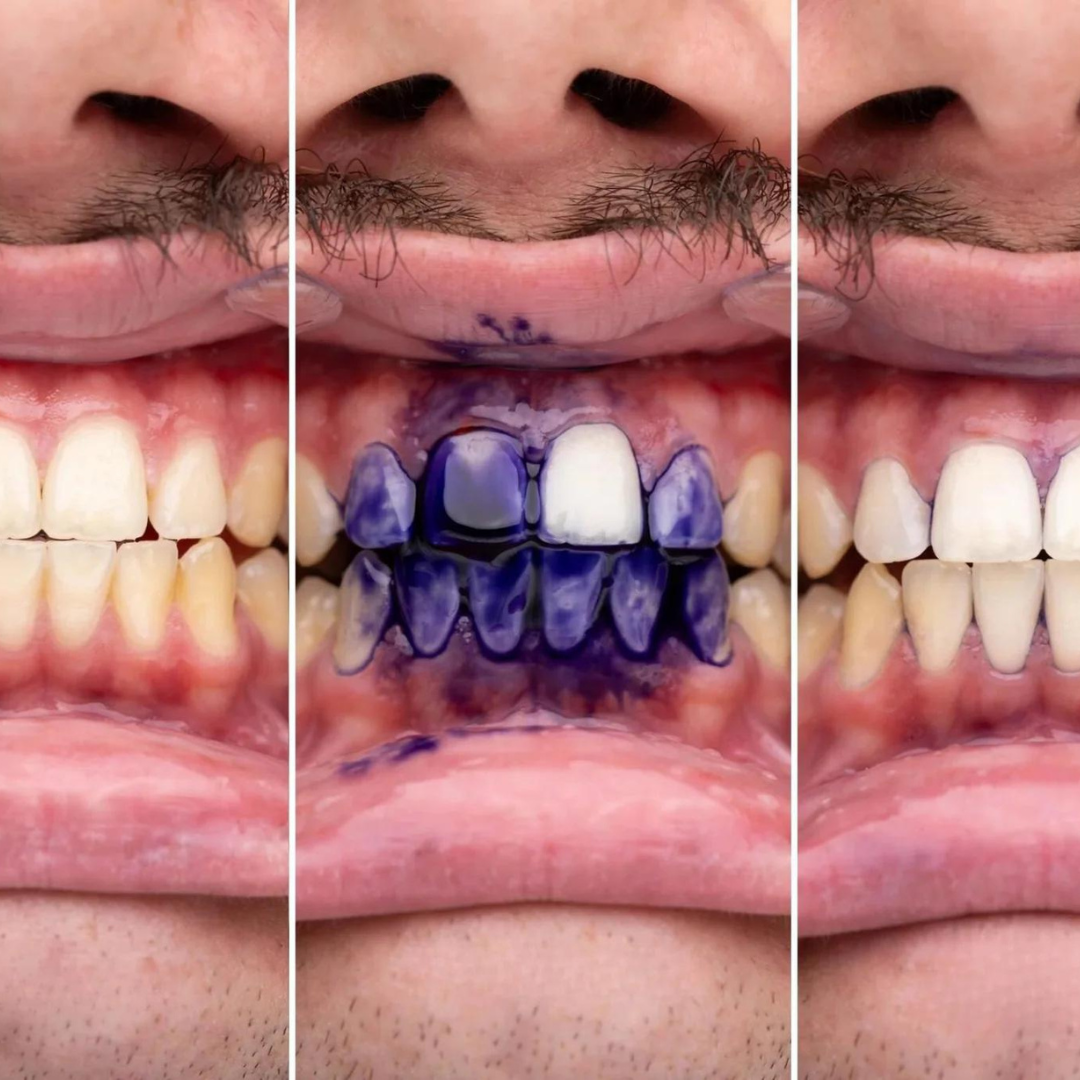 SmileKit™